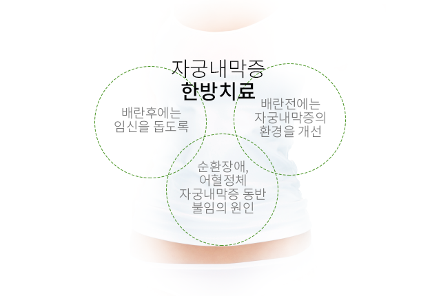 부산선근증으로 인한 불임 예방 5