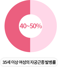 35세 이상 여성의 자궁근종 발병률